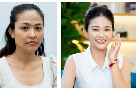 Trẻ hóa da toàn diện: Bước “lột xác” cho một khởi đầu mới