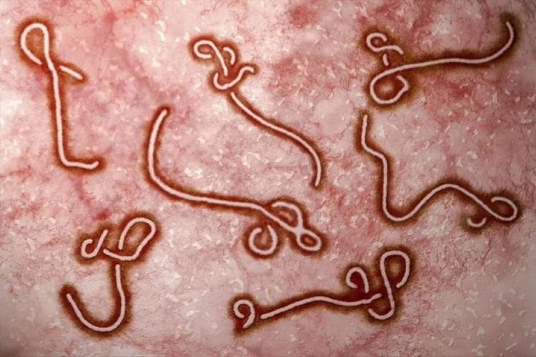 WHO báo động khẩn về Ebola ở châu Phi, Việt Nam tăng giám sát cửa khẩu
